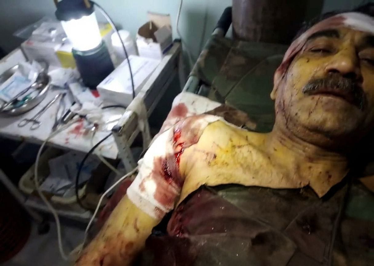 الصورة التي تظهر سيبان حمو مصابا مفبركة