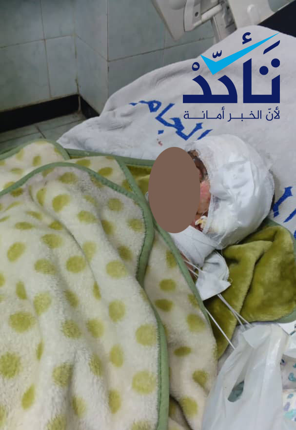 طفلة تتلقى الرعاية بالمشفى