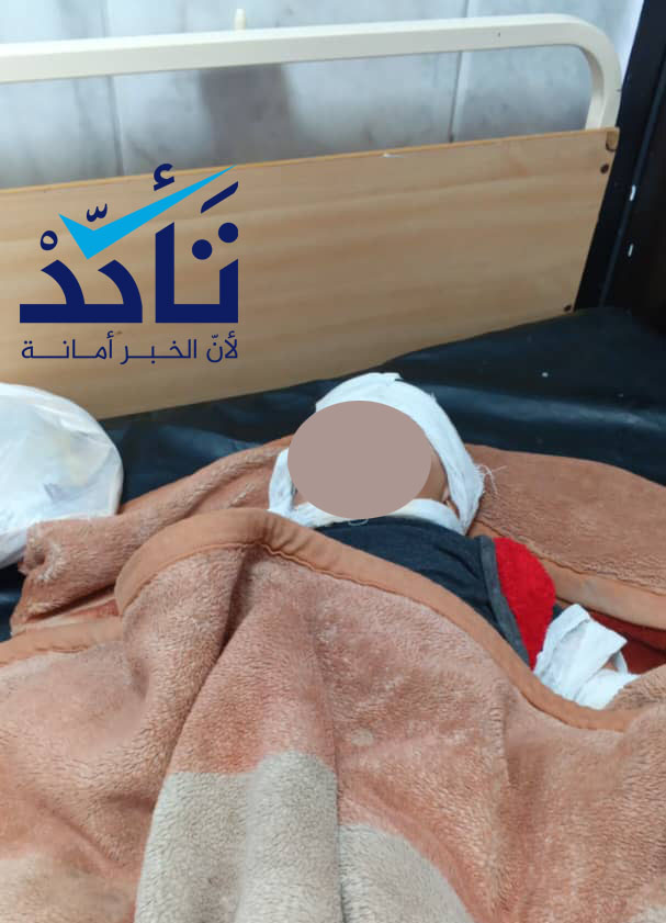 طفلة تتلقى الرعاية بالمشفى