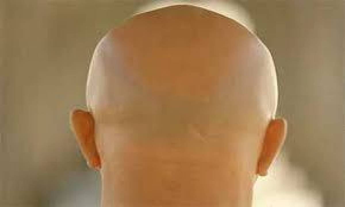 الصلعان لن يحولوا أشعة الشمس لطاقة 