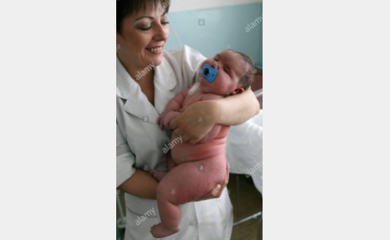 هل وضعت سيدة في أستراليا طفلا يزن 18 كيلوغراماً؟