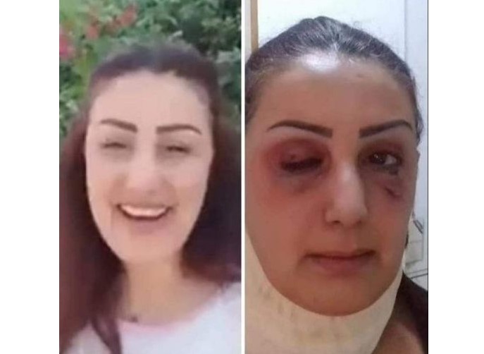 هل تعرضت مذيعة سورية للضرب بسبب انتقادها تدهور الأوضاع المعيشية؟